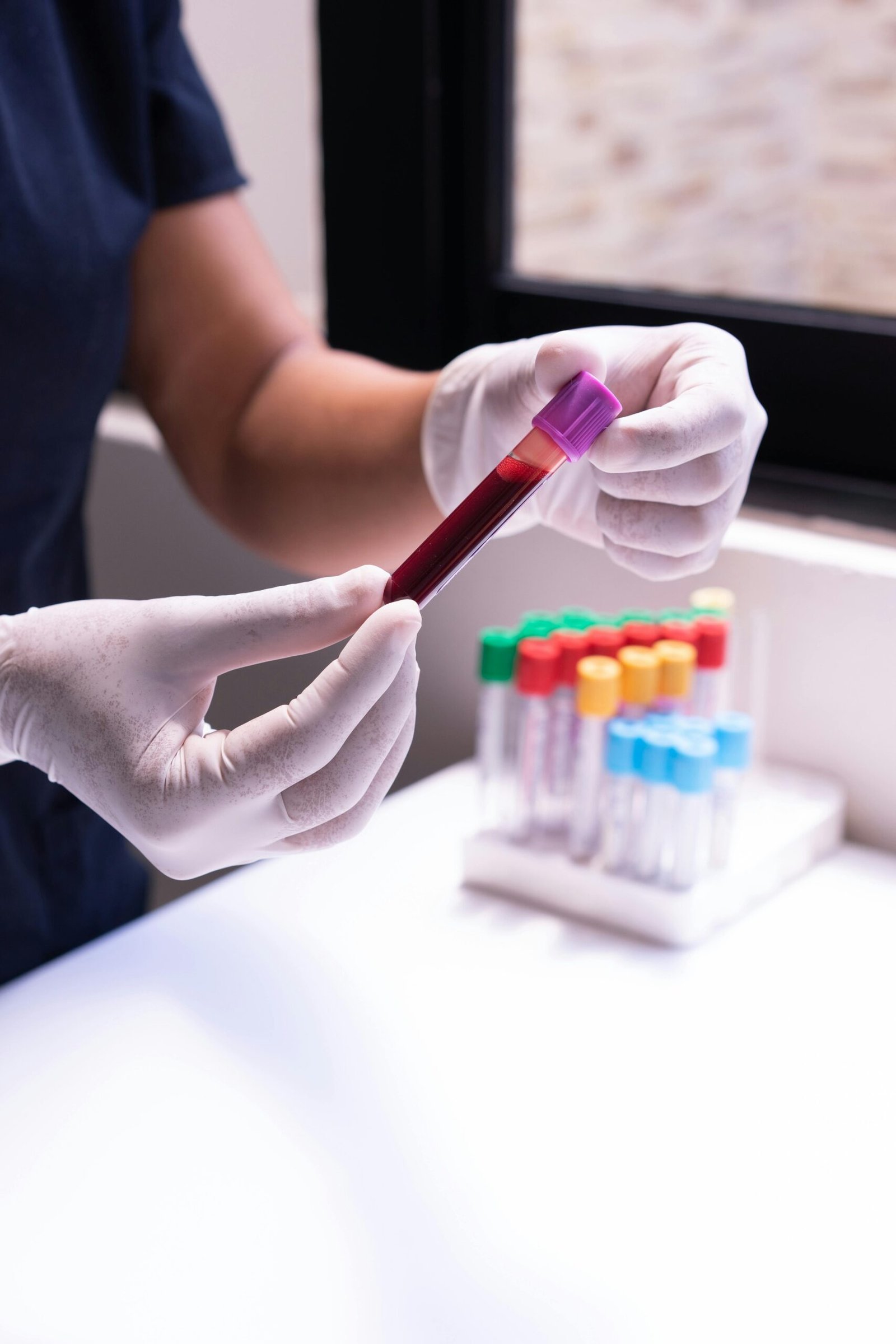 O que significa sonhar com sangue